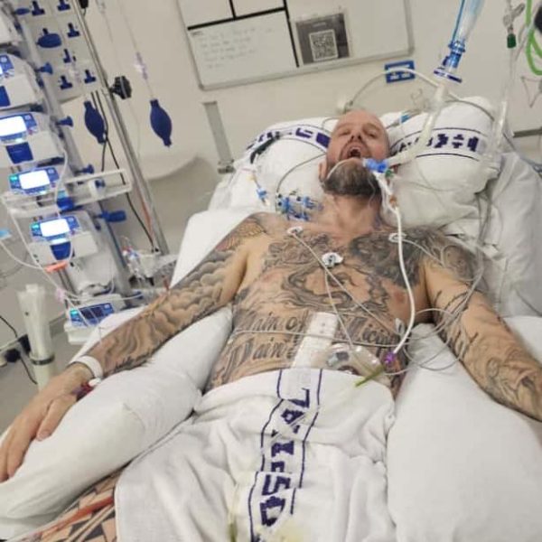 Davie After Surgery